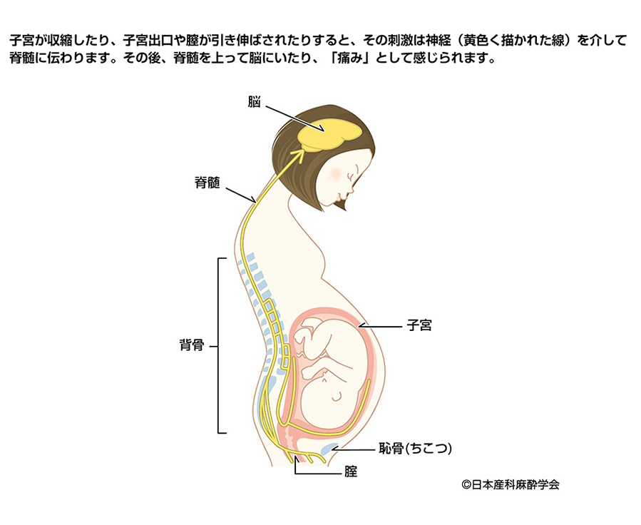 ・硬膜外麻酔の方法